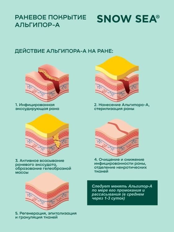 Альгипор-А покрытие (повязка) на раны и ожоги 60х100х10 мм